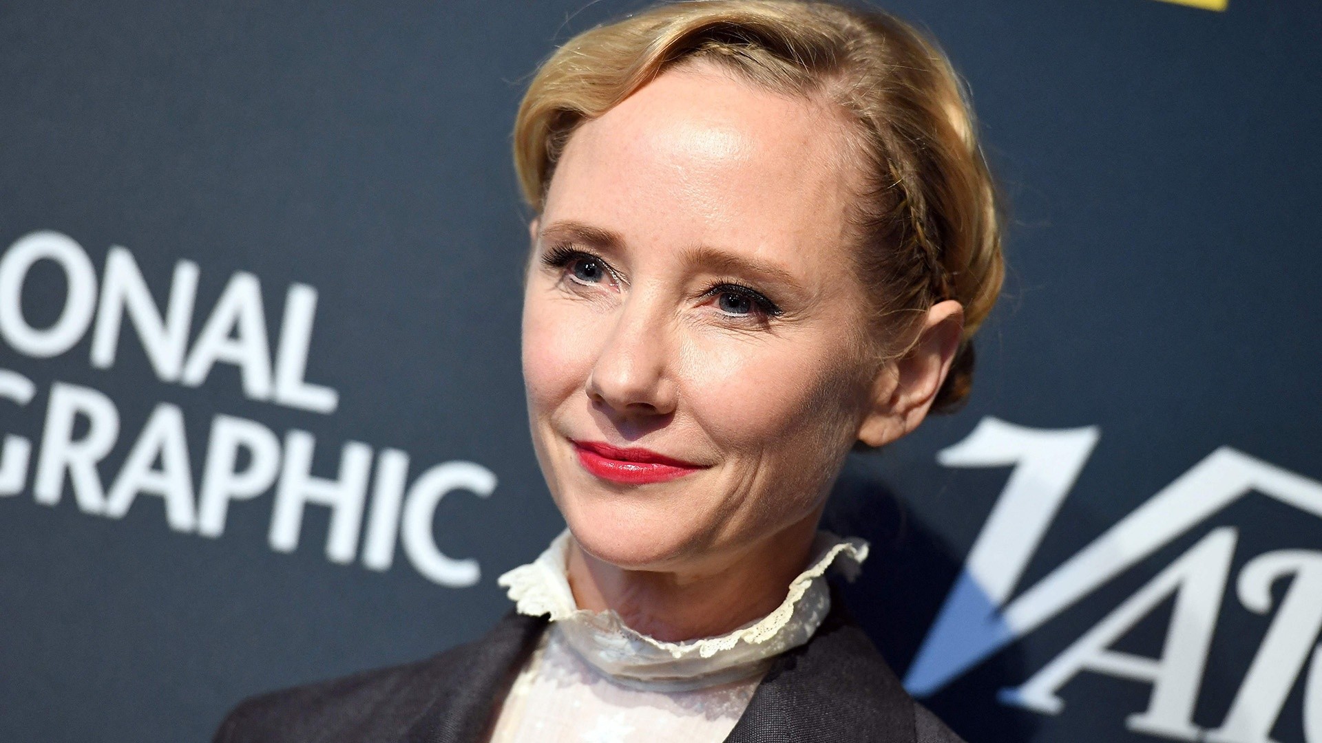 Anne Heche's autopsy report reveals new details on cause of death